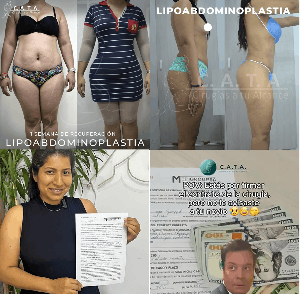 BePro_Caso_CATABlackFriday